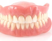 Como é Feita a Prótese Dentária (3)