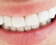 Como é Feita a Prótese Dentária (4)