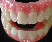 Como é Feita a Prótese Dentária (8)