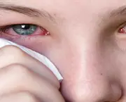 Como Tratar Coceira nos Olhos Causada por Alergias (1)