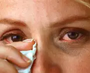 Como Tratar Coceira nos Olhos Causada por Alergias (16)