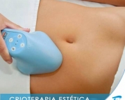 Crioterapia Estetica (10).jpg