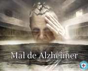 demencia-senil-a-doenca-de-alzheimer-2