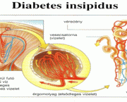 Diabetes Insipidus (2).gif