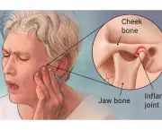 Distúrbio Temporo Mandibular (2)