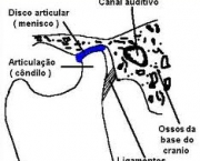 foto-disturbio-temporomandibular-01