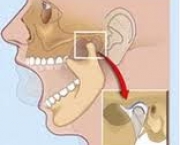 foto-disturbio-temporomandibular-08