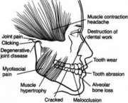 foto-disturbio-temporomandibular-11