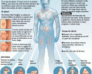 Doenca de Hodgkin (1)