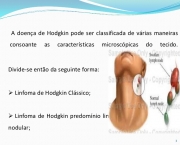 Doenca de Hodgkin (4)