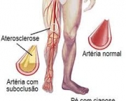 foto-doenca-vascular-periferica-02
