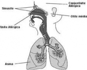 foto-enfisema-pulmonar-10