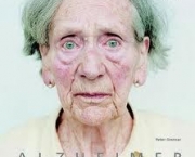 foto-envelhecimento-cerebral-12