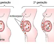 Eritroblastose Fetal (1)