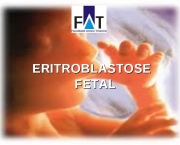 Eritroblastose Fetal (5)