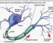 foto-esclerose-multipla-12