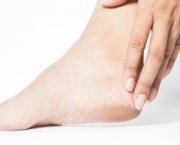 Woman cracked heels with white background, Foot healthy concept