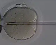 A injeção intracitoplasmática é uma técnica de reprodução assistida (Eugene Ermolovich/CRMI)