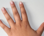 Flexor Superficial dos Dedos - Inervação (3)