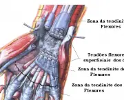 Flexor Superficial dos Dedos - Inervação (12)