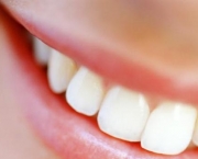 metodos-de-restauracao-dos-dentes-4