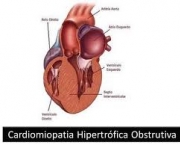 foto-miocardiopatia-hipertrofica-09