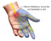 Músculo Flexor Superficial dos Dedos (4)