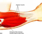 Músculos do Cotovelo - Origem e Inserção (2)