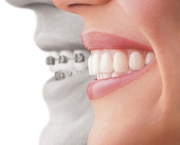 odontologia-estetica-6