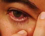 olho-seco-tratamento-e-sintomas-3