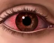 olho-seco-tratamento-e-sintomas-4