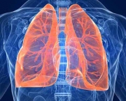 Pneumonia (2)