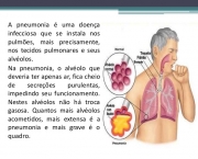 Pneumonia (5)