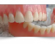 Prótese Dentária (1)