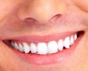 Prótese Dentária (11)
