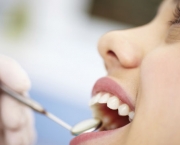 Restauração Dentária (3)