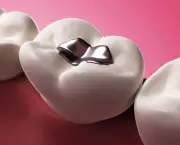Restauração Dentária (6)