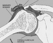 foto-sindrome-do-impacto-03