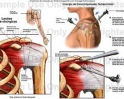 foto-sindrome-do-impacto-05