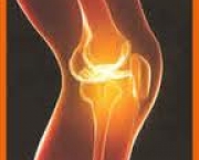 foto-sindrome-patelo-femoral-10