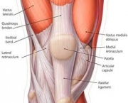 foto-sindrome-patelo-femoral-11