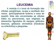 Sintomas e Tratamento da Leucemia (4)