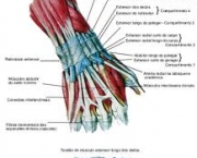 foto-tenossinovite-dos-extensores-dos-dedos-02
