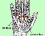foto-tenossinovite-dos-extensores-dos-dedos-04