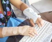 foto-tenossinovite-dos-extensores-dos-dedos-15