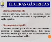 Tipos de Úlcera (3)