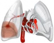 foto-tromboembolismo-pulmonar-13