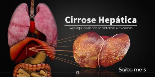 Cirrose Hepática 