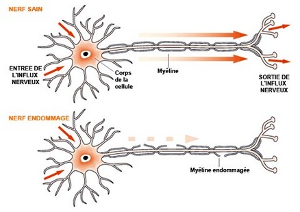 sindrome-2