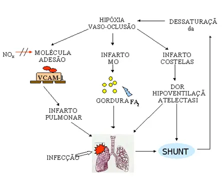 Fisiopatologia da Sepse